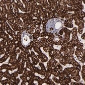 Anti-MAOB antibody produced in rabbit Prestige Antibodies&#174; Powered by Atlas Antibodies, affinity isolated antibody, buffered aqueous glycerol solution