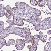 抗-ADAM12 兔抗 Prestige Antibodies&#174; Powered by Atlas Antibodies, affinity isolated antibody, buffered aqueous glycerol solution