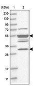 Anti-TMPPE antibody produced in rabbit Prestige Antibodies® Powered by Atlas Antibodies, affinity isolated antibody, buffered aqueous glycerol solution