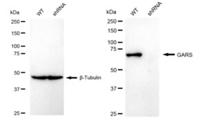 KD-Validated Anti GARS Antibody, clone 23GB5515, Rabbit Monoclonal clone 23GB5515, recombinant rabbit monoclonal, expressed in HEK293 cells