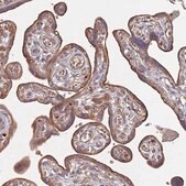 Anti-ATG5 antibody produced in rabbit Prestige Antibodies&#174; Powered by Atlas Antibodies, affinity isolated antibody, buffered aqueous glycerol solution