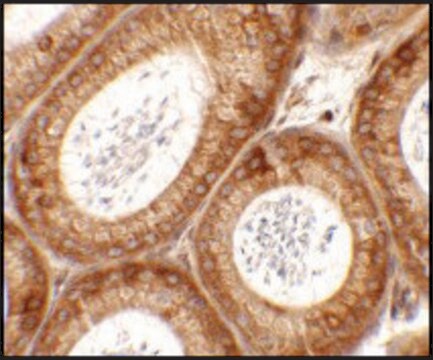 Anti-SPATA6 antibody produced in rabbit affinity isolated antibody