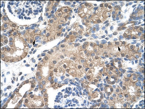 Anti-CHRNB2 antibody produced in rabbit IgG fraction of antiserum