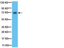Anti-Endoglin Antibody, clone P3D1 clone P3D1, from mouse
