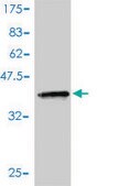 Monoclonal Anti-ACYP1 antibody produced in mouse clone 1B2-3A2, purified immunoglobulin, buffered aqueous solution