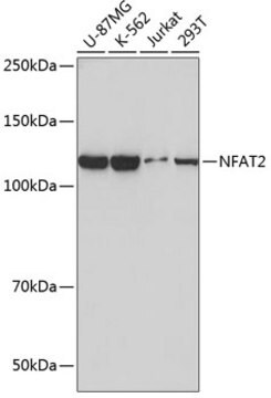 Anti-NFAT2 Antibody, clone 4I9P10, Rabbit Monoclonal