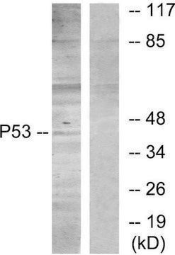 Anti-p53 antibody produced in rabbit affinity isolated antibody