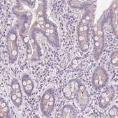 Anti-AHCYL2 antibody produced in rabbit Prestige Antibodies® Powered by Atlas Antibodies, affinity isolated antibody, buffered aqueous glycerol solution