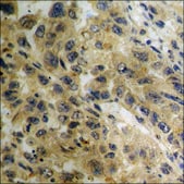 Anti-phospho-B-RAF (pSer602) antibody produced in rabbit affinity isolated antibody