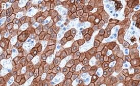 Anti-Cytokeratin 18 Antibody, clone 1G20 ZooMAb&#174; Rabbit Monoclonal recombinant, expressed in HEK 293 cells