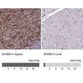 Anti-APOBR antibody produced in rabbit Prestige Antibodies® Powered by Atlas Antibodies, affinity isolated antibody, buffered aqueous glycerol solution