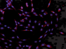 Anti-DCP2 (C-terminal) antibody produced in rabbit ~1 mg/mL, affinity isolated antibody, buffered aqueous solution