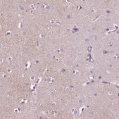 Anti-GPR37L1 antibody produced in rabbit Prestige Antibodies&#174; Powered by Atlas Antibodies, affinity isolated antibody, buffered aqueous glycerol solution