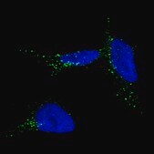 Monoclonal Anti-TYRP1 antibody produced in mouse Prestige Antibodies&#174; Powered by Atlas Antibodies, clone CL4906, purified immunoglobulin, buffered aqueous glycerol solution