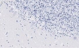 Anti-S100-B Antibody, clone 8F20 ZooMAb® Rabbit Monoclonal recombinant, expressed in HEK 293 cells