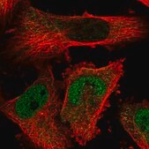 Anti-TMPPE antibody produced in rabbit Prestige Antibodies® Powered by Atlas Antibodies, affinity isolated antibody, buffered aqueous glycerol solution