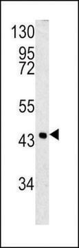 ANTI-SPB3(N-TERMINAL) antibody produced in rabbit purified immunoglobulin, buffered aqueous solution