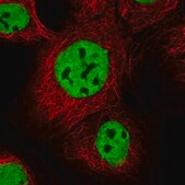 Anti-IBTK antibody produced in rabbit Prestige Antibodies&#174; Powered by Atlas Antibodies, affinity isolated antibody, buffered aqueous glycerol solution
