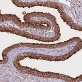 Anti-EXOSC8 antibody produced in rabbit Prestige Antibodies&#174; Powered by Atlas Antibodies, affinity isolated antibody, buffered aqueous glycerol solution