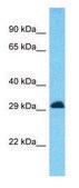 Anti-CD81 (C-terminal) antibody produced in rabbit affinity isolated antibody