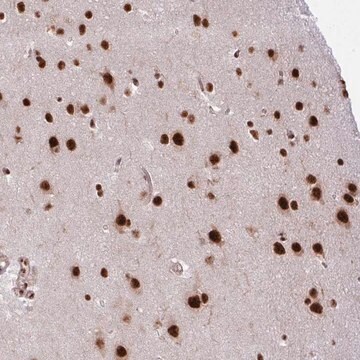 Anti-CHERP antibody produced in rabbit Prestige Antibodies&#174; Powered by Atlas Antibodies, affinity isolated antibody, buffered aqueous glycerol solution