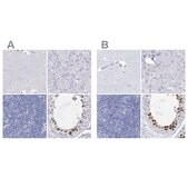 Anti-ACRV1 antibody produced in rabbit Prestige Antibodies® Powered by Atlas Antibodies, affinity isolated antibody, buffered aqueous glycerol solution