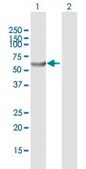 Anti-PHGDH antibody produced in mouse purified immunoglobulin, buffered aqueous solution