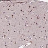 Anti-TPRX1 antibody produced in rabbit Prestige Antibodies® Powered by Atlas Antibodies, affinity isolated antibody, buffered aqueous glycerol solution