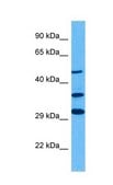 Anti-GLIS3 antibody produced in rabbit affinity isolated antibody