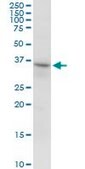 Anti-RNF144 antibody produced in mouse IgG fraction of antiserum, buffered aqueous solution