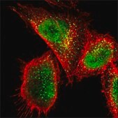 ANTI-CDK19 antibody produced in rabbit Prestige Antibodies® Powered by Atlas Antibodies, affinity isolated antibody, buffered aqueous glycerol solution
