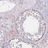 Anti-HAO1 antibody produced in rabbit Prestige Antibodies&#174; Powered by Atlas Antibodies, affinity isolated antibody, buffered aqueous glycerol solution