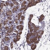 Anti-AAK1 antibody produced in rabbit Prestige Antibodies&#174; Powered by Atlas Antibodies, affinity isolated antibody, buffered aqueous glycerol solution