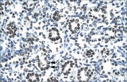 Anti-HOXB9 antibody produced in rabbit affinity isolated antibody