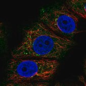 Anti-RABEP2 antibody produced in rabbit Prestige Antibodies&#174; Powered by Atlas Antibodies, affinity isolated antibody, buffered aqueous glycerol solution
