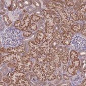 Anti-IVD antibody produced in rabbit Prestige Antibodies® Powered by Atlas Antibodies, affinity isolated antibody, buffered aqueous glycerol solution