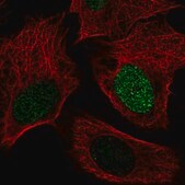 Anti-SMIM6 antibody produced in rabbit Prestige Antibodies® Powered by Atlas Antibodies, affinity isolated antibody, buffered aqueous glycerol solution