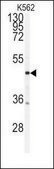 Anti-CAMK2&#948;-like (C-term) antibody produced in rabbit IgG fraction of antiserum, buffered aqueous solution