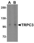 Anti-TRPC3 (ab1) antibody produced in rabbit affinity isolated antibody, buffered aqueous solution