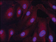 Anti-WAVE-1 antibody produced in rabbit ~2 mg/mL, affinity isolated antibody, buffered aqueous solution