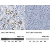 Anti-SLC12A1 antibody produced in rabbit Prestige Antibodies® Powered by Atlas Antibodies, affinity isolated antibody, buffered aqueous glycerol solution
