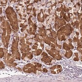 Anti-TMED6 antibody produced in rabbit Prestige Antibodies&#174; Powered by Atlas Antibodies, affinity isolated antibody, buffered aqueous glycerol solution