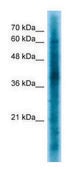 Anti-CRKL antibody produced in rabbit affinity isolated antibody