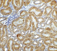 Anti-CAD (ab2) antibody produced in rabbit affinity isolated antibody, buffered aqueous solution