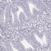 Anti-TKTL1 antibody produced in rabbit Prestige Antibodies&#174; Powered by Atlas Antibodies, affinity isolated antibody, buffered aqueous glycerol solution