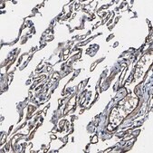 Anti-KLHL42 antibody produced in rabbit Prestige Antibodies&#174; Powered by Atlas Antibodies, affinity isolated antibody, buffered aqueous glycerol solution