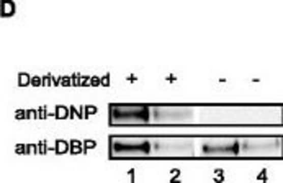 Anti-Vitamin D-Binding Protein/GC antibody produced in goat affinity isolated antibody, buffered aqueous solution