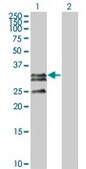 Monoclonal Anti-C1QTNF2 antibody produced in mouse clone 1D7-2C7, purified immunoglobulin, buffered aqueous solution