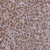 Anti-GJB5 antibody produced in rabbit Prestige Antibodies® Powered by Atlas Antibodies, affinity isolated antibody, buffered aqueous glycerol solution
