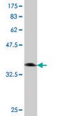 Monoclonal Anti-NVL, (C-terminal) antibody produced in mouse clone 3D10, purified immunoglobulin, buffered aqueous solution
